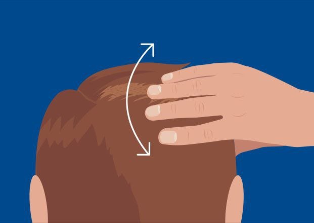 روجين محلول رجال مينوكسيديل 5% يكفي لمدة 3 أشهر | Men's ROGAINE 5% Minoxidil Solution 3 Month Supply - الصورة 10